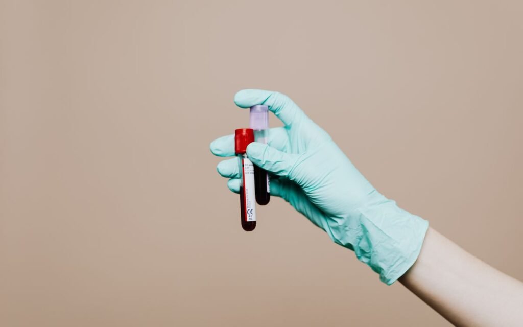 gloved hand holding blood sample tubes for a vitamin B12 deficiency test